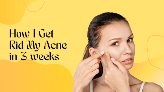 High Frequency Devices for Clearing Acne
