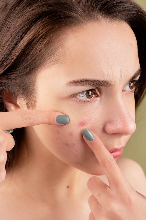 How to Use High Frequency WandfFor Acne Treatment and Prevention ProFacialWand