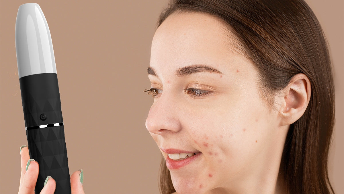 Discover The Benefits Of High Frequency Facial Wands Lucsuer Discover the benefits of high frequency facial wands lucsuer