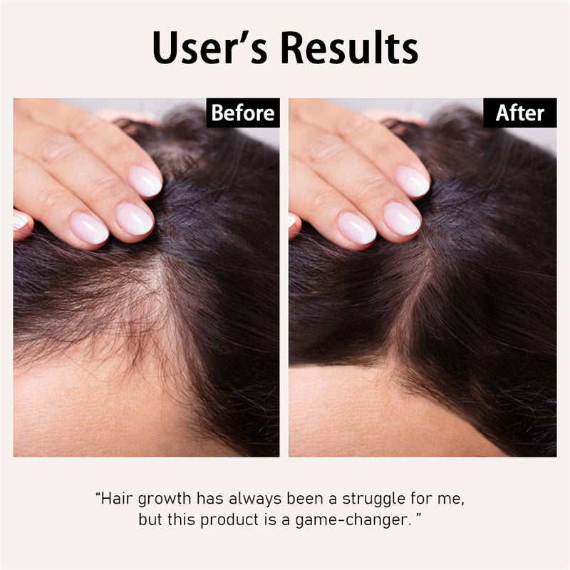 Cordless 3in1 High Frequency Wand - OxyGlow 1 - Neon Gas – Lucsuer